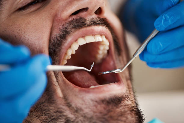 Why Choose Us for Your Dental Needs in Mount Carmel, OH